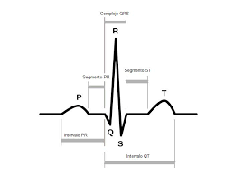 Lectura e Interpretación de ECG.